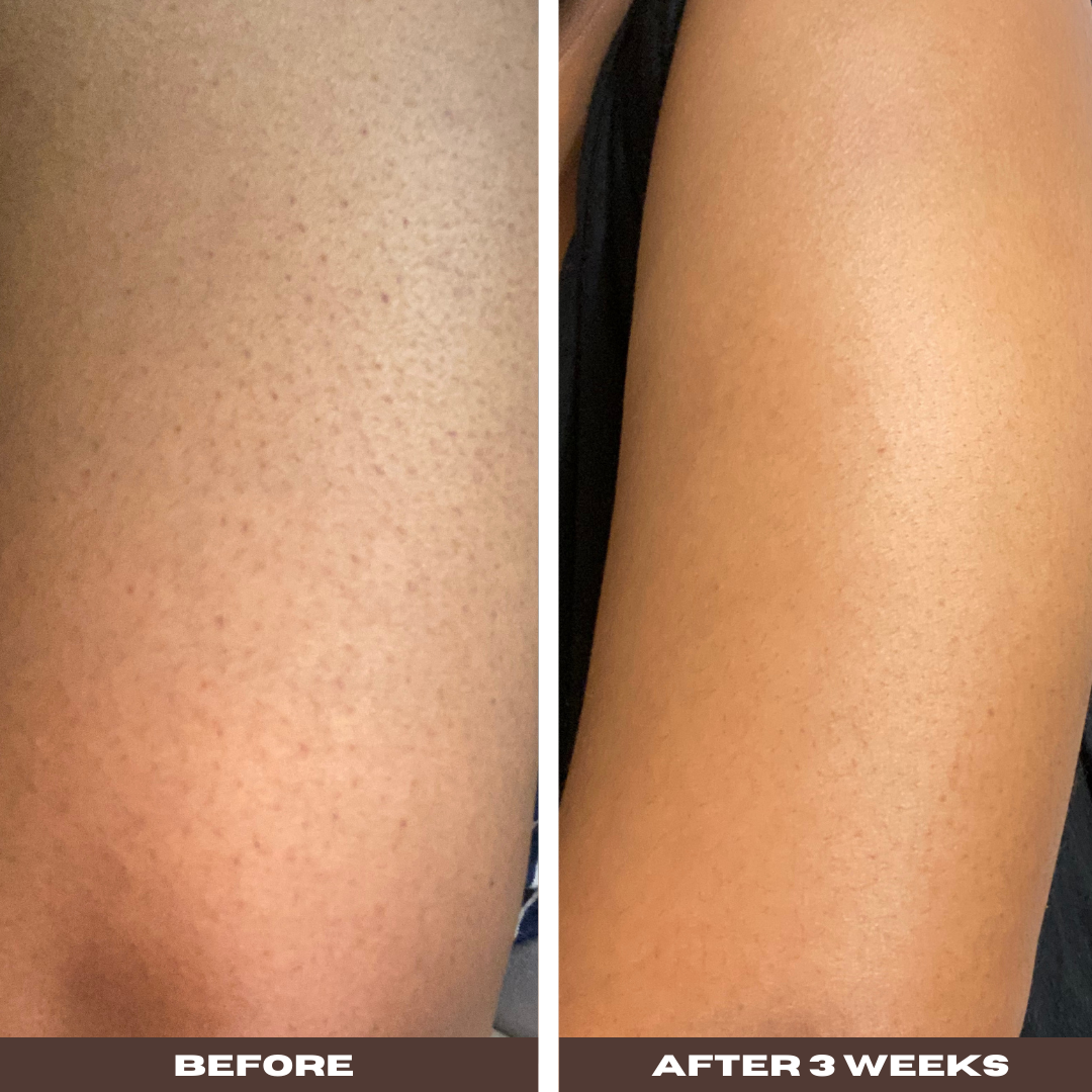 Deep Seeded Roots AHA Glycolic Moisturizer body lotion before and after on arms
